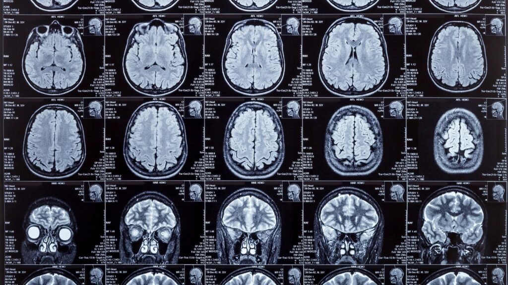 A modern technológiák, mint például a funkcionális mágneses rezonanciavizsgálat (fMRI) vagy az EEG, lehetővé teszik az agyi aktivitást megfigyelését vásárlás közben.